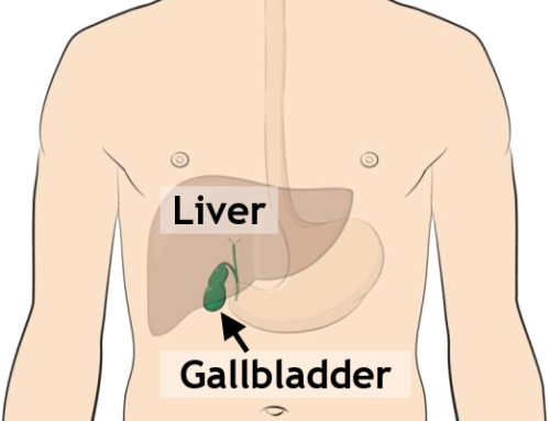 Gallbladder Disease – Treatment and Surgical Options with daVinci® Single-Site